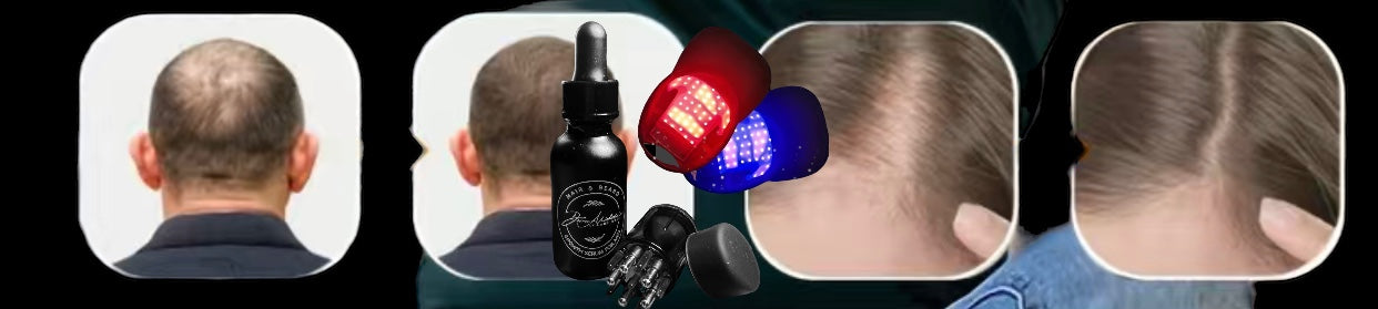 222 Black Laser Red and Blue Light Hair Growth Therapy Cap For Men