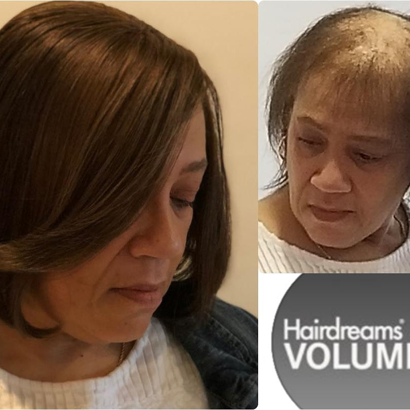 Hairdreams Volume Plus Hair Thickening System Consultation for Hair Loss 2 Hour
